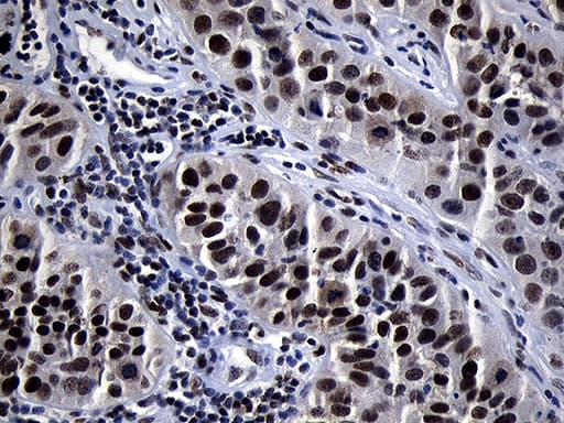 Monoclonal Mouse anti-Human ZHX2 / RAF Antibody (clone OTI2E11, aa595-837, IHC, WB)