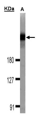 DOCK180 / DOCK1 Antibody (aa1802-1865)