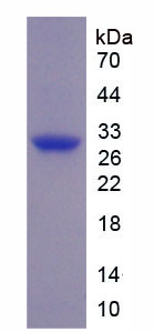 Pig CTGF Protein (Recombinant His)