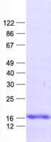Human DAT1 / LMO3 Protein (Recombinant His, N-Terminal)