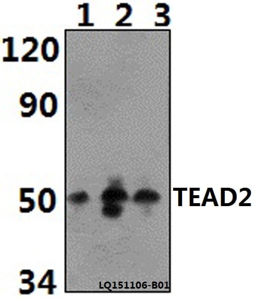 TEAD2 Antibody