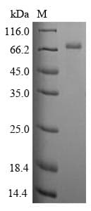 Human CLU / Clusterin Protein (Recombinant 10His-SUMO, N-terminus + Myc, C-terminus)