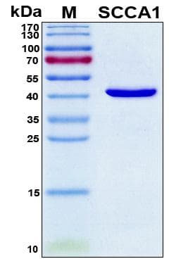 Human SERPINB3 Protein (Recombinant 6His, N-terminus)