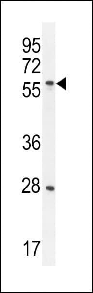 DLK1 / Pref-1 Antibody
