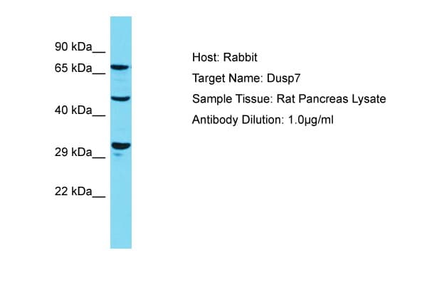 DUSP7 Antibody (aa139-188)