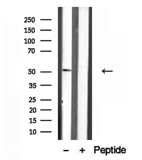 IFT52 Antibody