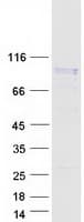Human WEE1 Protein (Recombinant Myc-DDK (Flag))