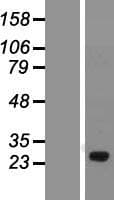 C1orf111 Protein (Over-Expression Lysate Myc-DDK (Flag))