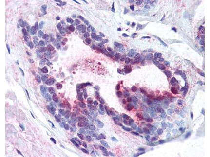 PDCD4 Antibody (phospho-Ser457)