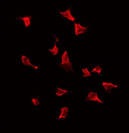 Polyclonal Rabbit anti-Human KRT19 / CK19 / Cytokeratin 19 Antibody (IHC, IF, WB)