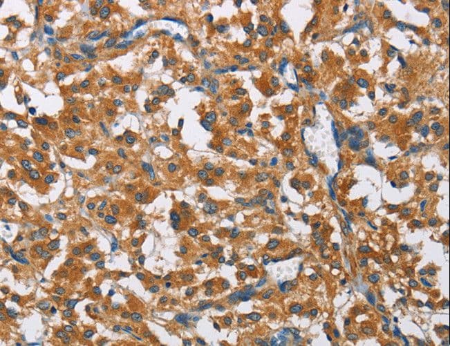 Polyclonal Rabbit anti-Human COPB1 / Beta-COP Antibody (IHC, WB)