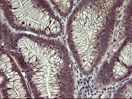 MMP13 Antibody (aa104-471, clone OTI3A7, Carrier-free)
