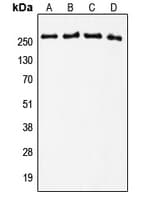 Polyclonal Rabbit anti-Human TNC / Tenascin C Antibody (Internal, WB)