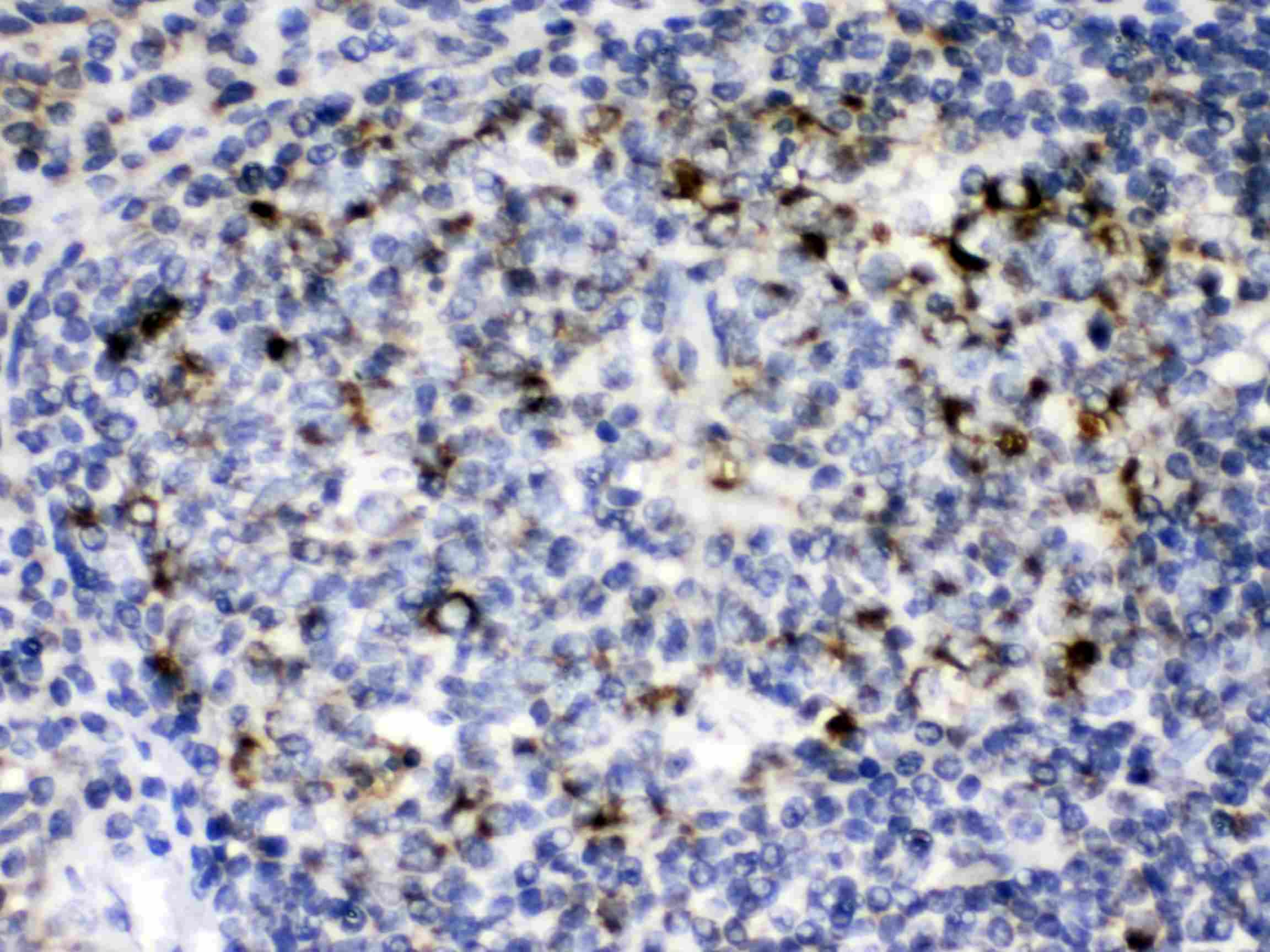 GC1qR / C1QBP Antibody