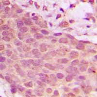 RELA / NFKB p65 Antibody (phospho-Ser536)