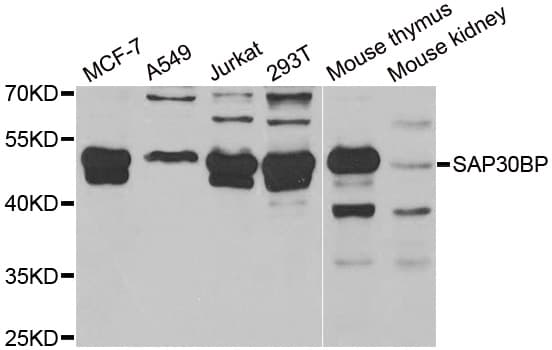 Polyclonal Rabbit anti-Human SAP30BP / HTRG Antibody (IHC, WB)