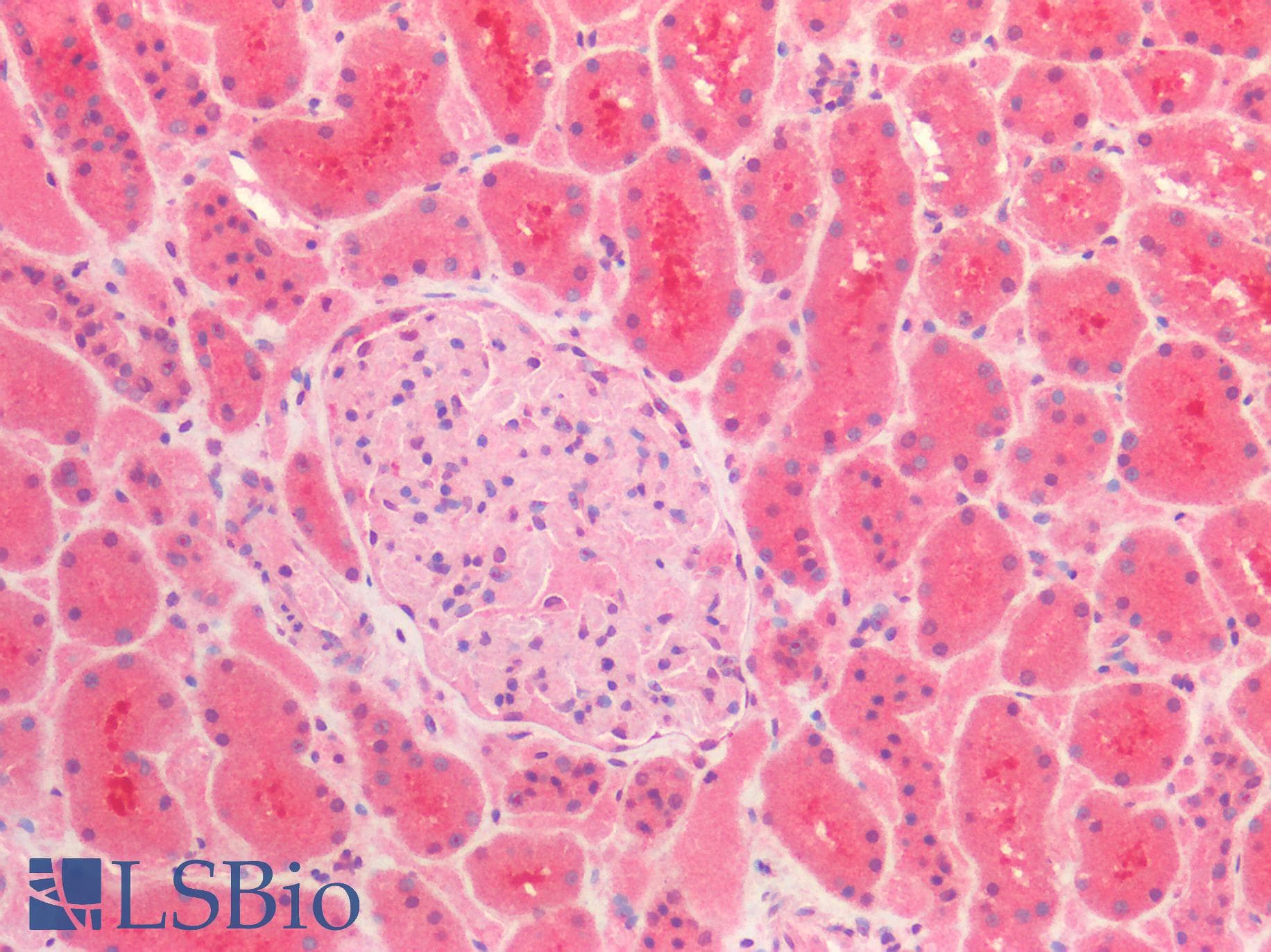 IHC-plus™ Polyclonal Rabbit anti-Human TNC / Tenascin C Antibody (IHC)