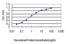 Monoclonal Mouse anti-Human CDC42BPA / MRCK Antibody (clone 1G7, WB)