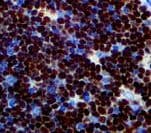 DNTT / TdT Antibody (clone RBT-TdT)