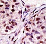 HRS / HGS Antibody (aa256-286)