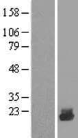 UBE2D4 Protein (Over-Expression Lysate Myc-DDK (Flag))