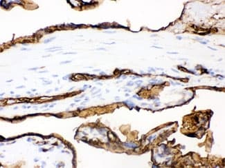 SLC2A1 / GLUT-1 Antibody (aa92-492)