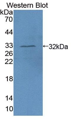 AIM1 Antibody (aa1502-1719, PE)