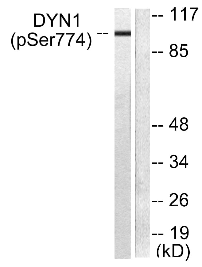 Polyclonal Rabbit anti-Human DNM1 / Dynamin Antibody (phospho-Ser774, IHC, WB)