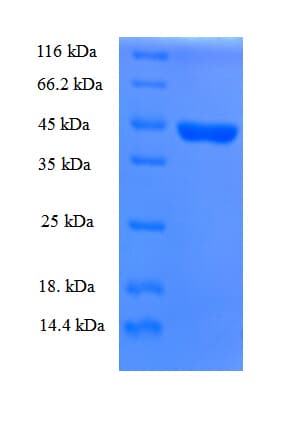 Human CHRNA1 Protein (Recombinant 6His, N-terminus)