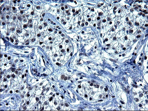 SMAD1 Antibody (clone OTI1C2)