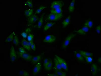 Polyclonal Rabbit anti-Human REPS1 Antibody (IHC, IF)