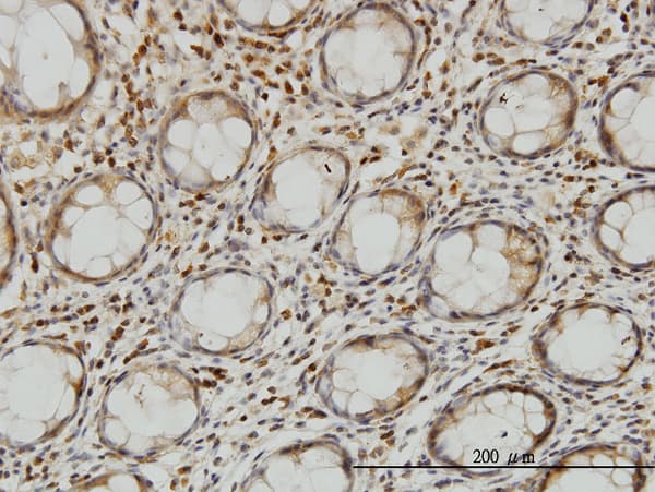 LZTFL1 Antibody (clone 7F6)
