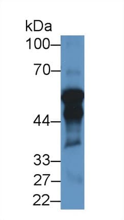 P450SCC / CYP11A1 Antibody (aa44-287)