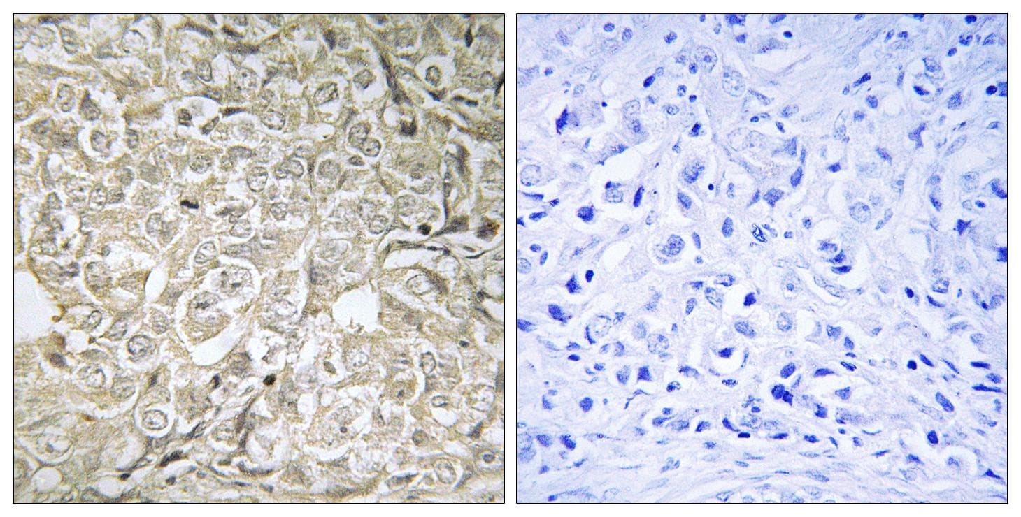 Polyclonal Rabbit anti-Human RAB37 Antibody (IHC, WB)