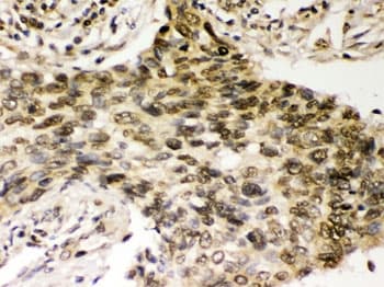 CHEK2 / CHK2 Antibody