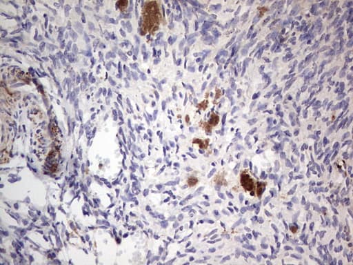 Monoclonal Mouse anti-Human PKM2 Antibody (clone 11B11, IHC, WB)