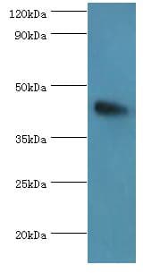 ANGPTL4 Antibody (aa26-406)