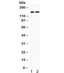 Polyclonal Rabbit anti-Human HDAC6 Antibody (WB)