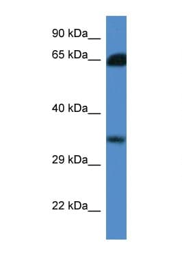 MRI1 Antibody (aa100-149)