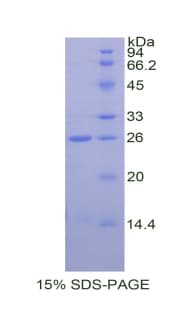 Rat SPTAN1 / Alpha Fodrin Protein (Recombinant His)