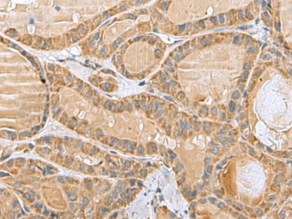 MRPL40 Antibody