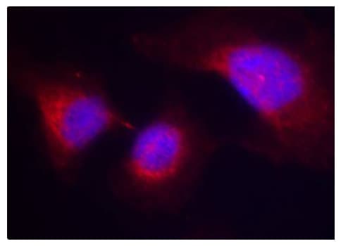 SYK Antibody (phospho-Tyr323)