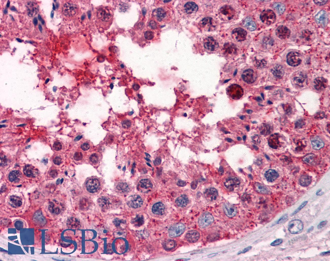 IHC-plus™ GYG1 / Glycogenin Antibody (clone 3B5)
