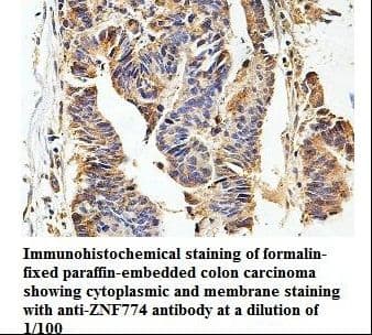 Polyclonal Rabbit anti-Human ZNF774 Antibody (aa142-422, IHC, WB)