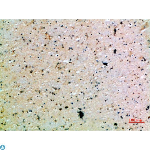 Polyclonal Rabbit anti-Human PDGF-CC Antibody (IHC)