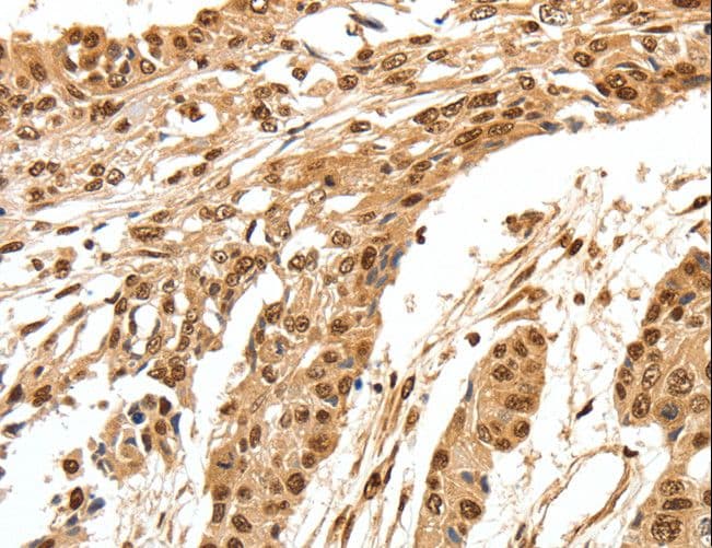 SPATA20 Antibody