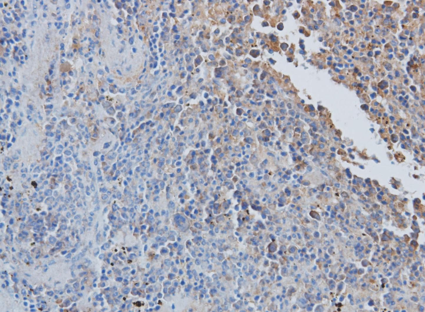 CCL7 / MCP3 Antibody