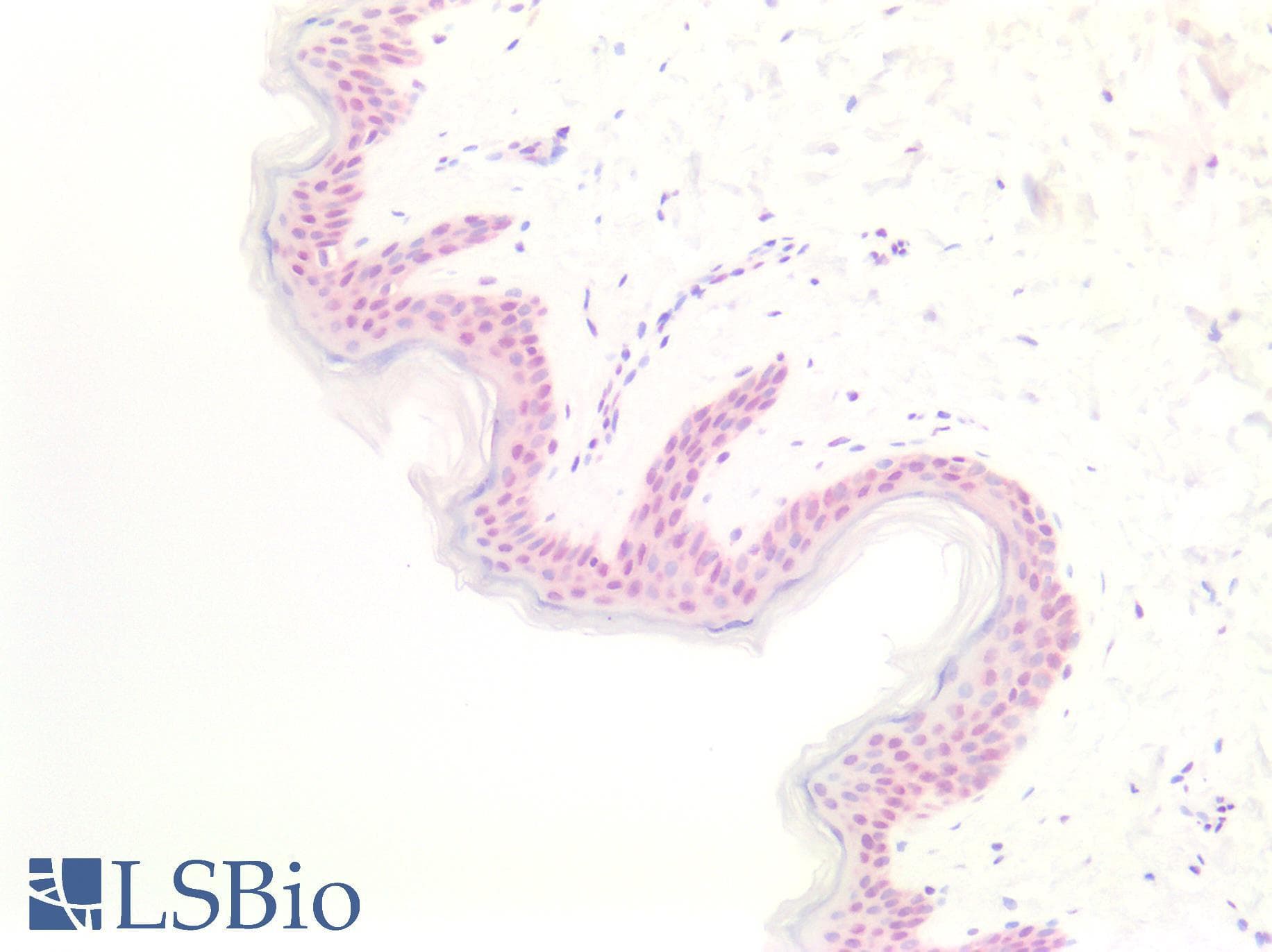 PathPlus™ MEN1 / Menin Antibody (aa575-C-term)