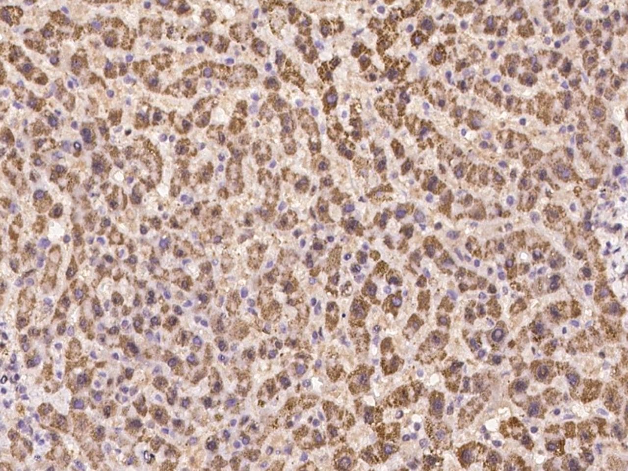DENND1B Antibody