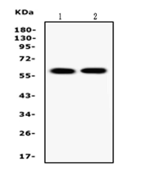 SLC1A2 / EAAT2 / GLT-1 Antibody (aa461-574)